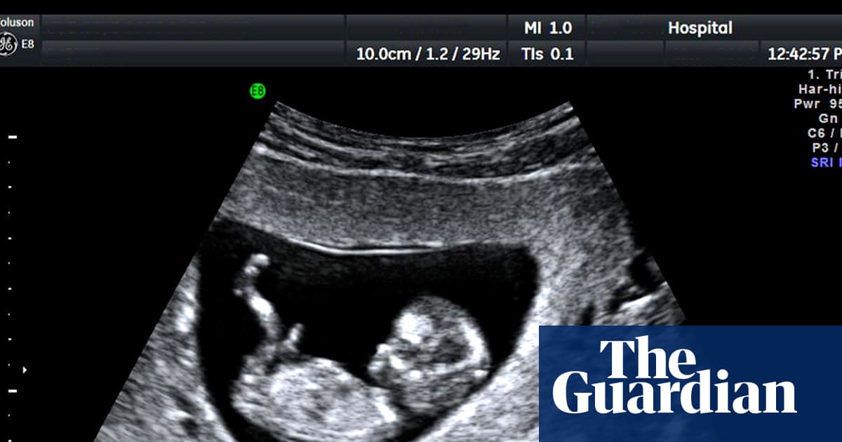 Experts Warn That Unregulated Pregnancy Scan Clinics in the UK Are Endangering Lives – Mirror Brief